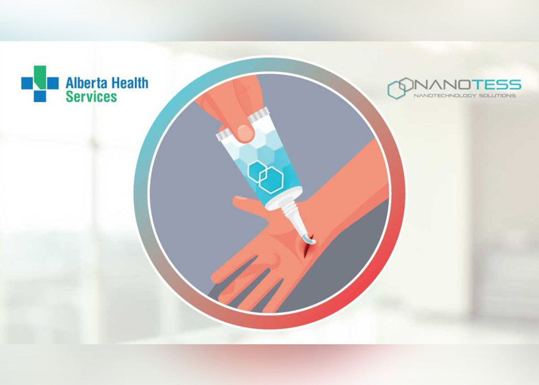 CAN Health Network partners with Alberta Health Services and NanoTess to implement and evaluate NanoSALV Catalytic across multiple healthcare settings